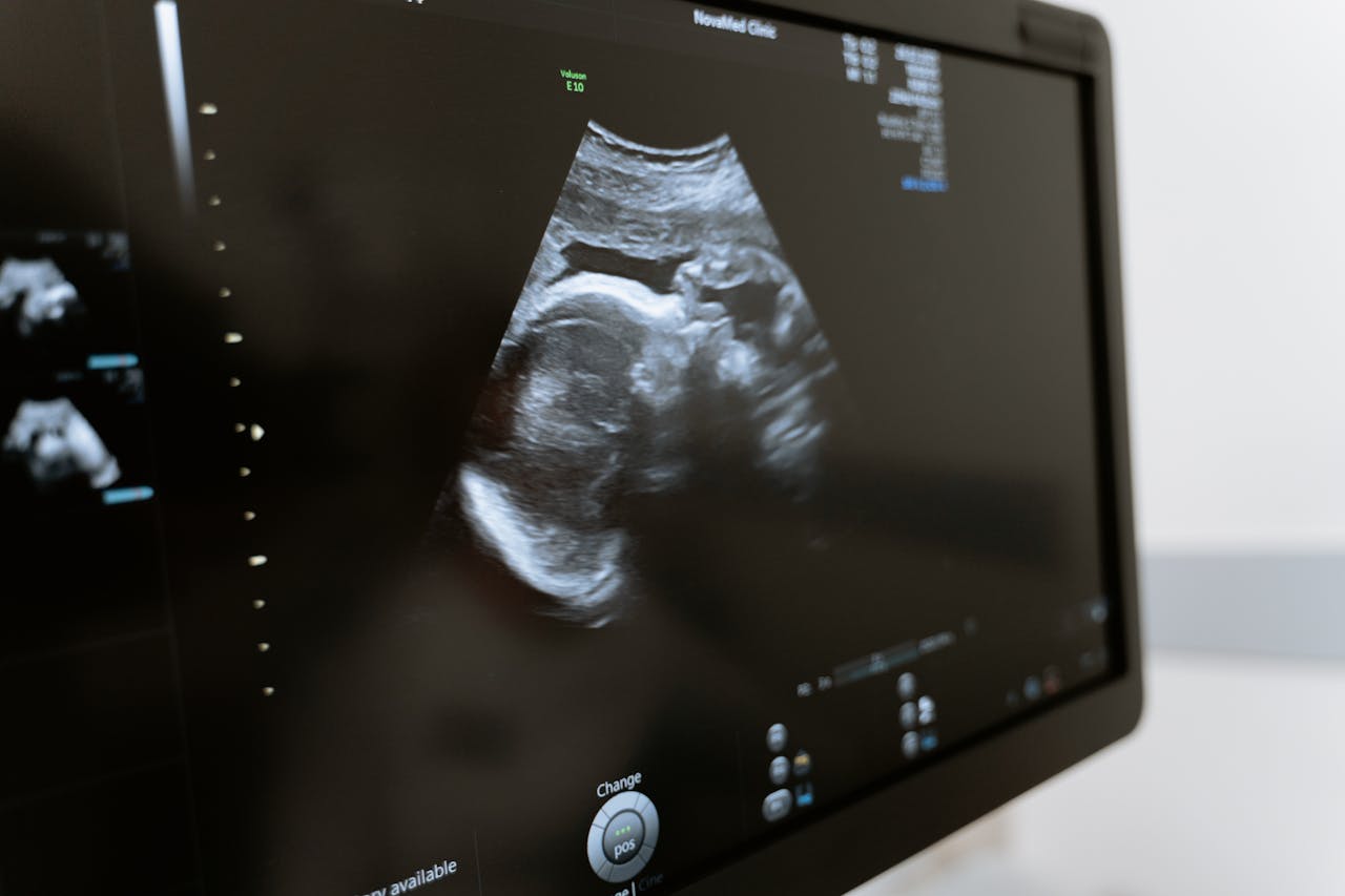 Close-up of an ultrasound showing a fetus on a monitor in a medical clinic.